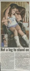 Not a leg to stand on — New York Post